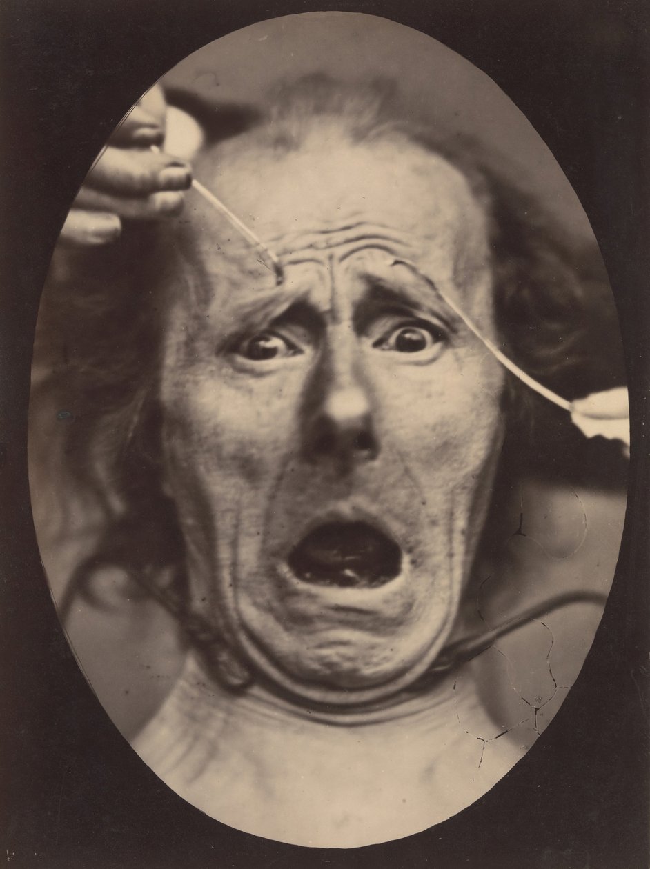 Elektro-Physiologie, Figur 64 von Adrien Alban Tournachon