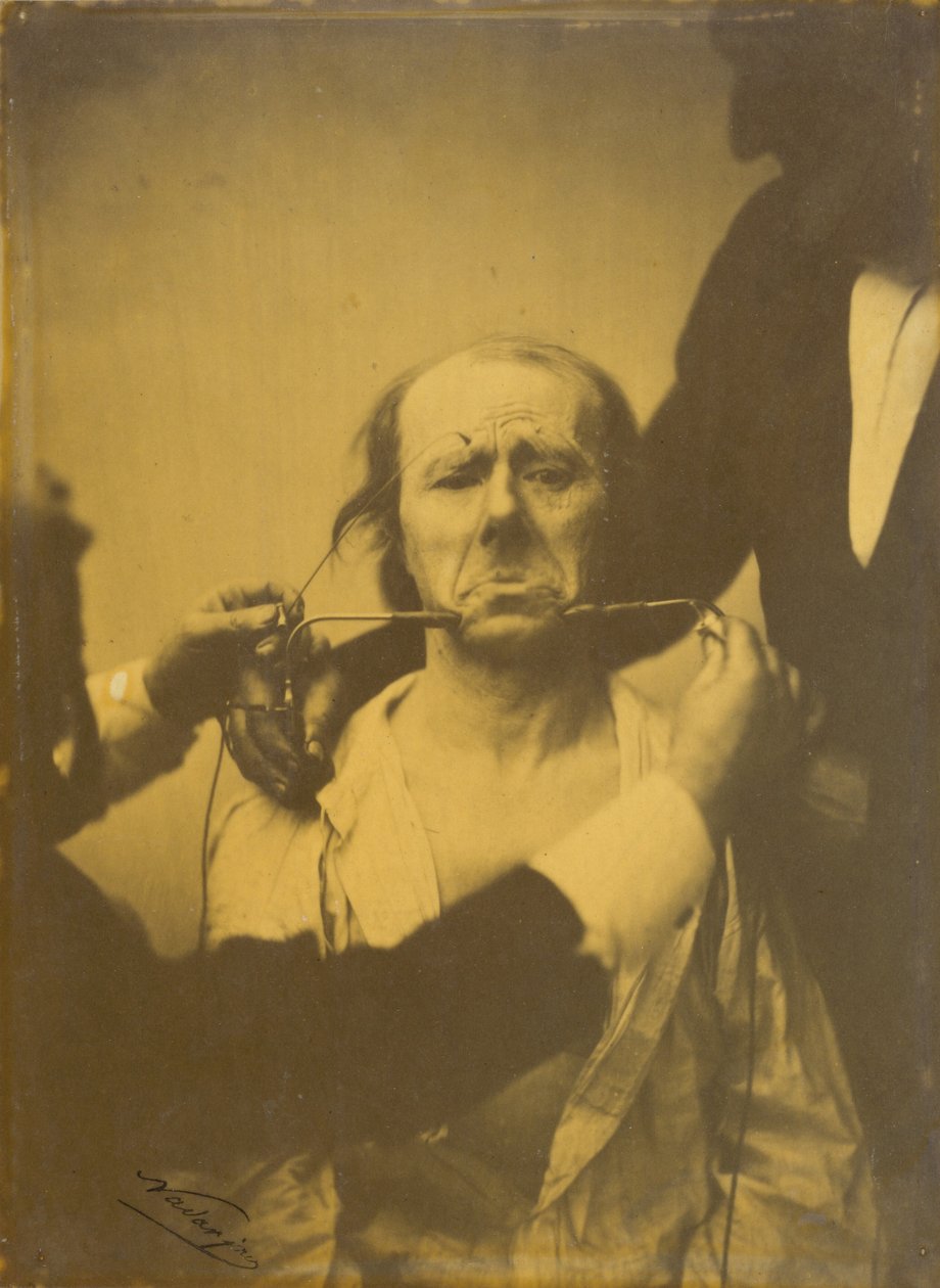 Schmerz und Verzweiflung, 1854-1856, gedruckt 1862 von Duchenne de Boulogne
