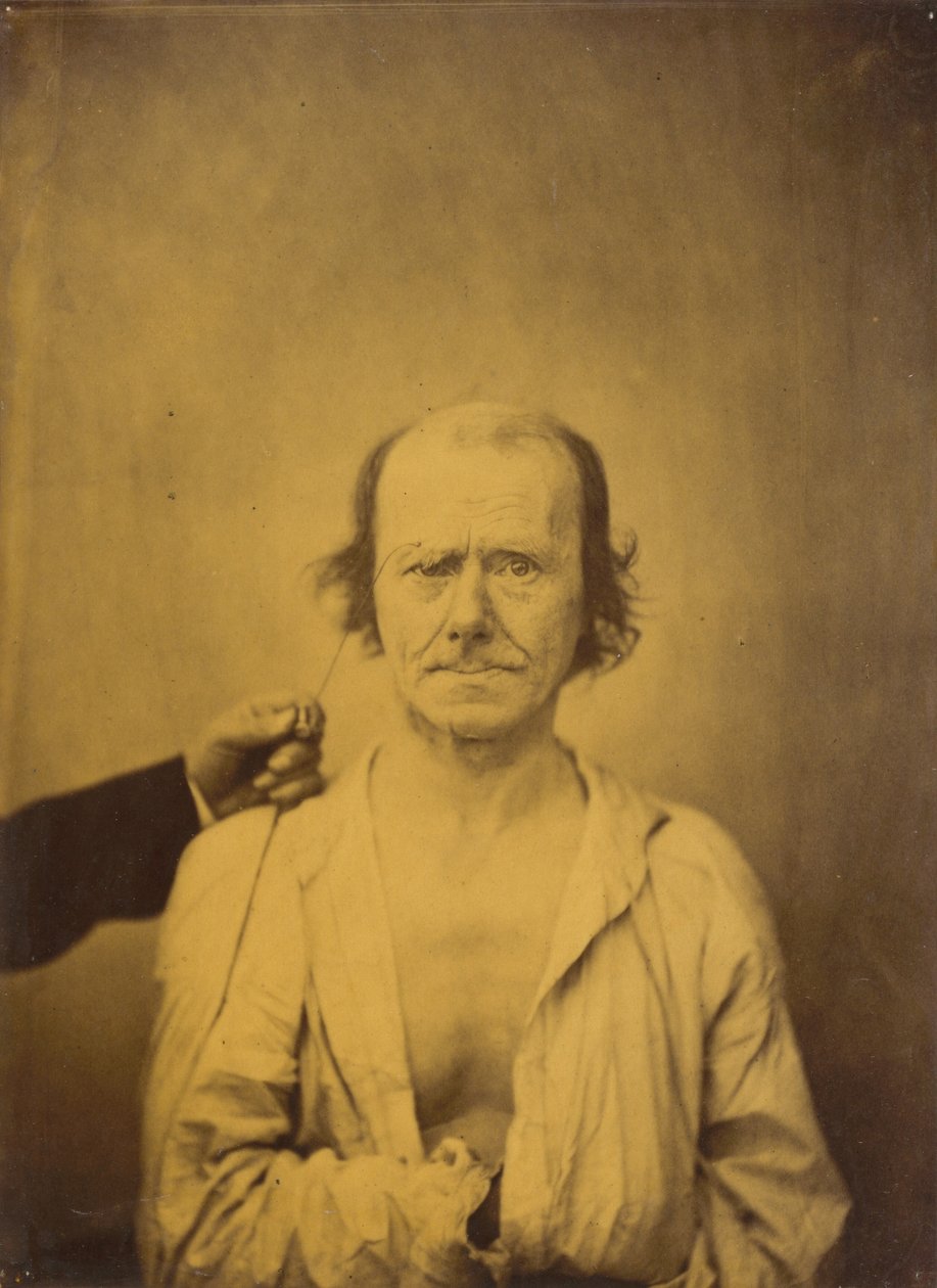 Aufmerksamkeit (links); Reflexion (rechts) von Guillaume Benjamin Amant Duchenne