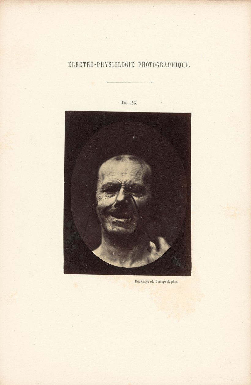Elektro-Physiologie Fotografisch, Figur 53 von Guillaume Benjamin Duchenne