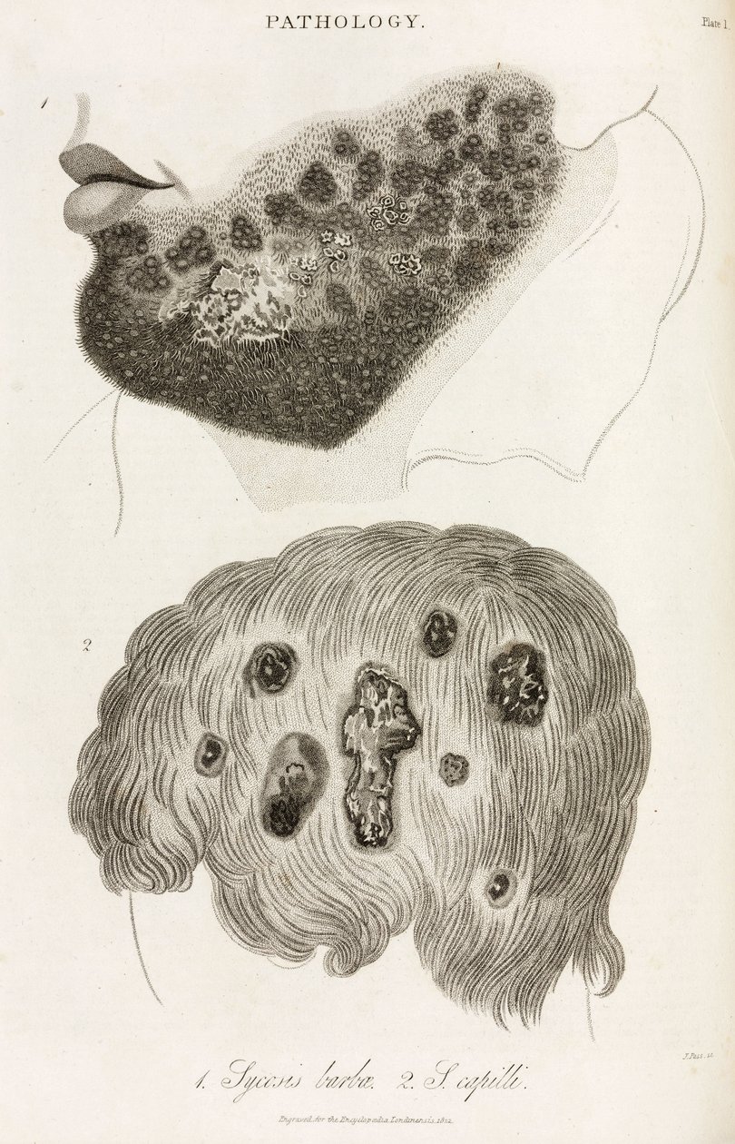 Dermatologie Hautkrankheiten von John Pardon