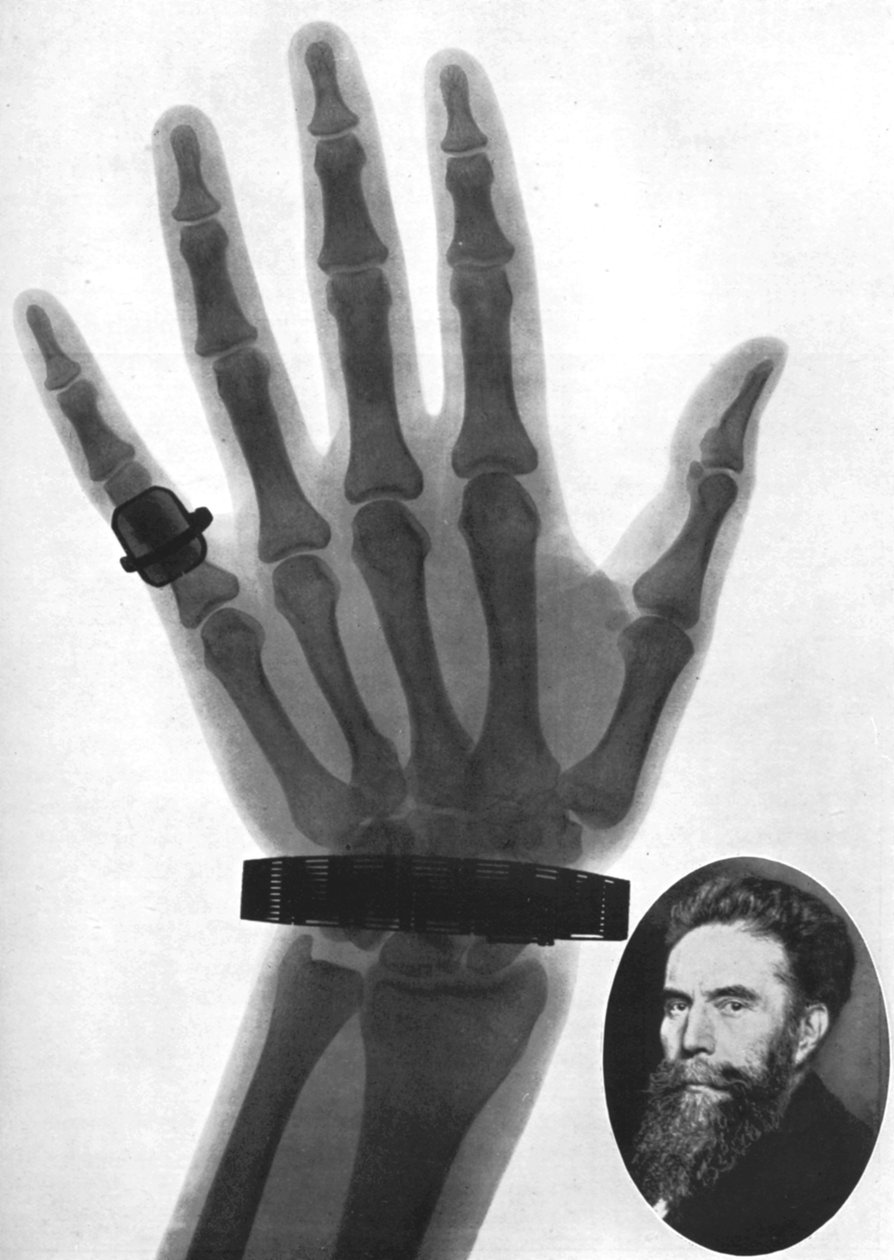 Röntgenaufnahme einer Hand, 1926 von Unbekannt
