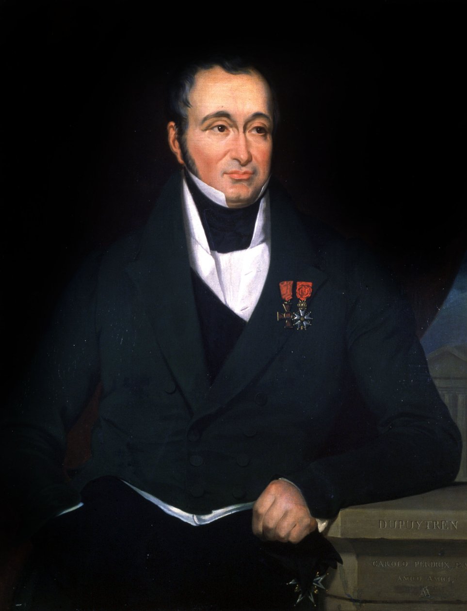 Der Arzt Dupuytren, ca. 1820 von Unbekannter Künstler