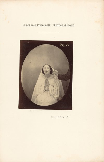 Électro-Physiologie Photographique, Abbildung 76 von Guillaume Benjamin Duchenne