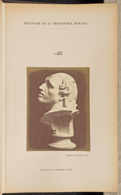 Abb. 66 von Guillaume Benjamin Duchenne