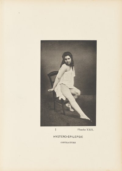 Hystero-Epilepsie Kontraktur von Paul Marie Léon Regnard