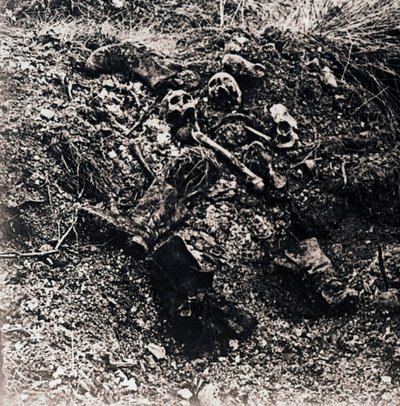 Menschliche Überreste, ca. 1914-1918 von Unbekannt