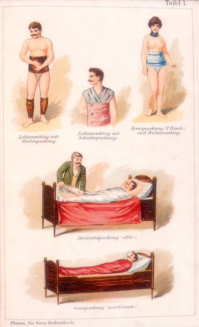 Hydrotherapie-Behandlungen, ca. 1902 von Unbekannt