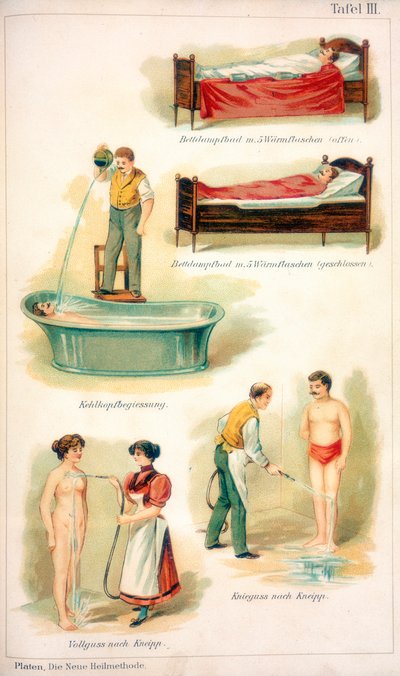 Hydrotherapie-Behandlungen, um 1902 von Unbekannt