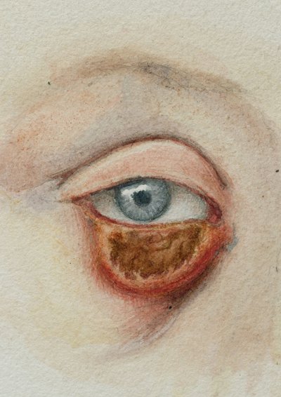 Augen von Frederick (attr. to) Barnard
